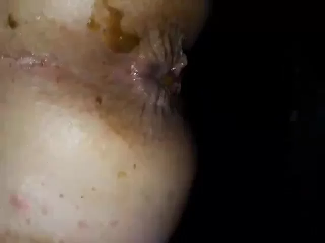 Анус Язык Фото Анус Язык Фото